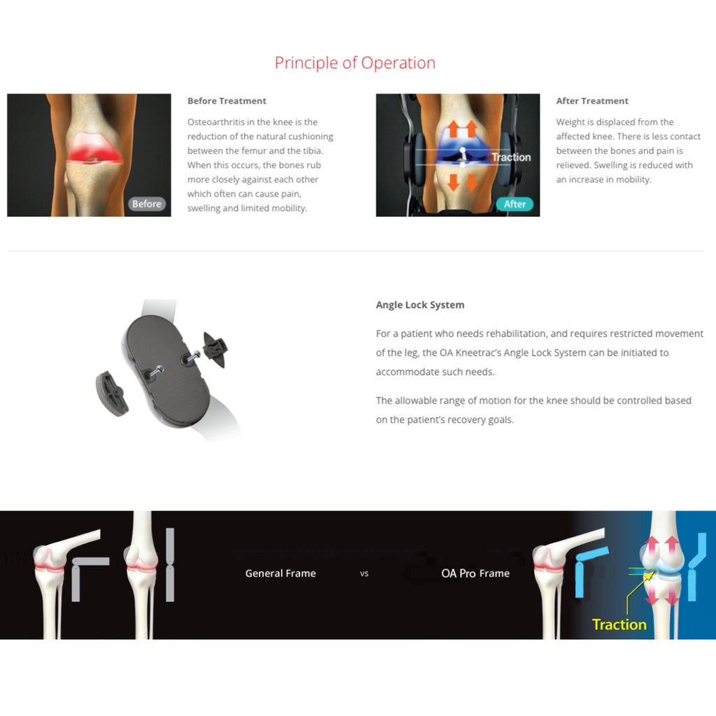 DDS OA PRO Slim Dual Unloading Osteoarthritis Knee Brace